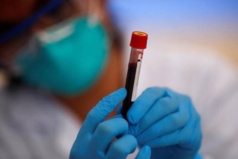 ثورة جديدة في الطب: اختبار دم ثلاثي الأبعاد يتنبأ بالنوبات القلبية قبل 30 عاماً من حدوثها !