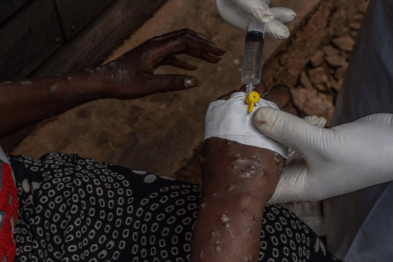 RDC: L'OMS achemine le premier lot de vaccins anti-mpox