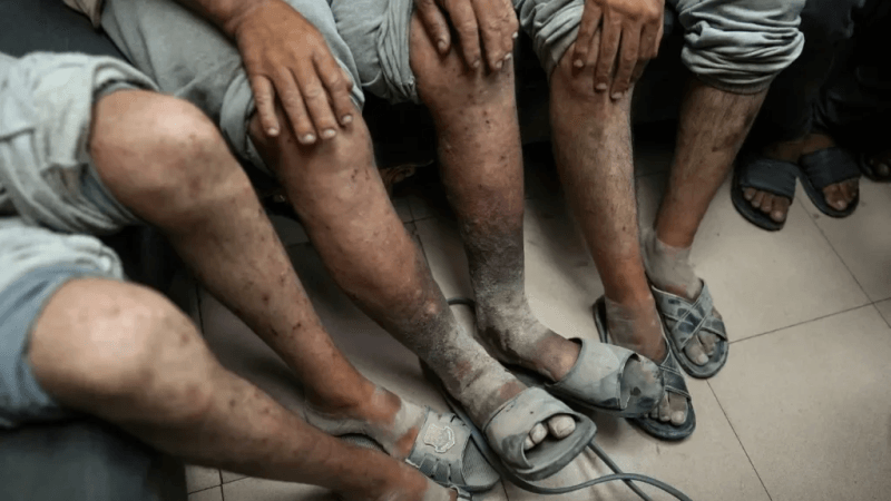 كسر الأصابع وتحقيق الديسكو..شهادات مروّعة لمعتقلين في سجون الإحتلال