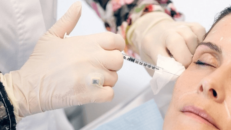 وهيبة شيبوب: الأداءات الديوانية وراء ارتفاع كلفة علاجات التجميل