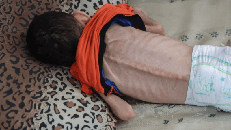 بينهم 85 طفلا.. ارتفاع عدد 'شهداء الجوع' في غزة إلى 127