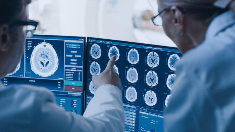 Angleterre : Une IA accélère le diagnostic des AVC