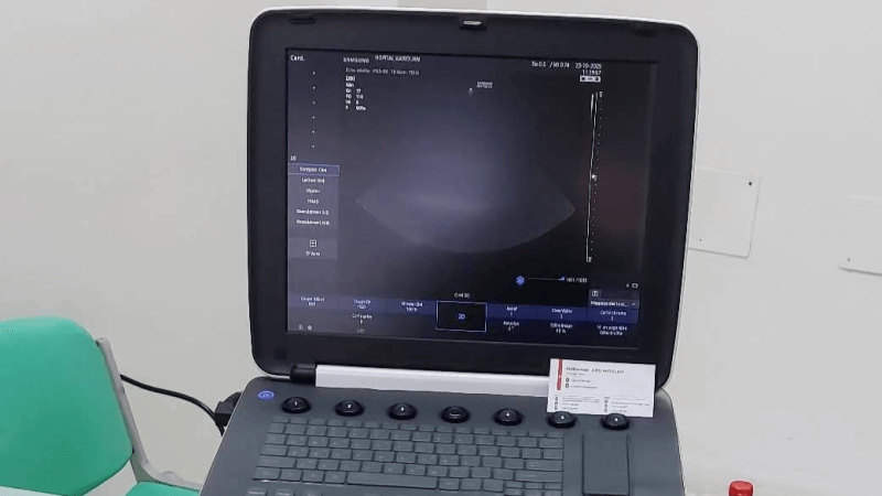 تزويد قسم الأطفال بمستشفى ابن الجزار بالقيروان بجهاز تصوير