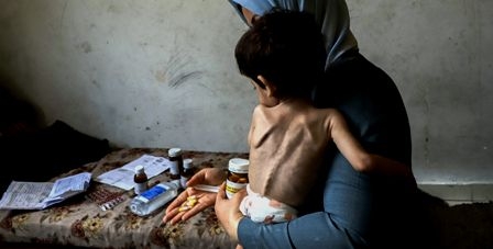 Les enfants continuent de mourir de faim et de déshydratation à Gaza