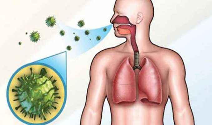 مدنين: حملات لتفادي عدوى وباء السل العقدي‎‎