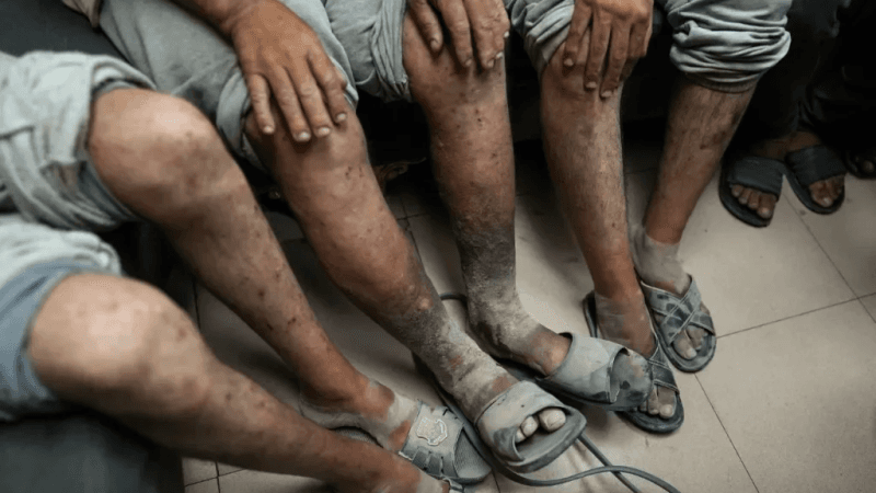 كسر الأصابع وتحقيق الديسكو..شهادات مروّعة لمعتقلين في سجون الإحتلال
