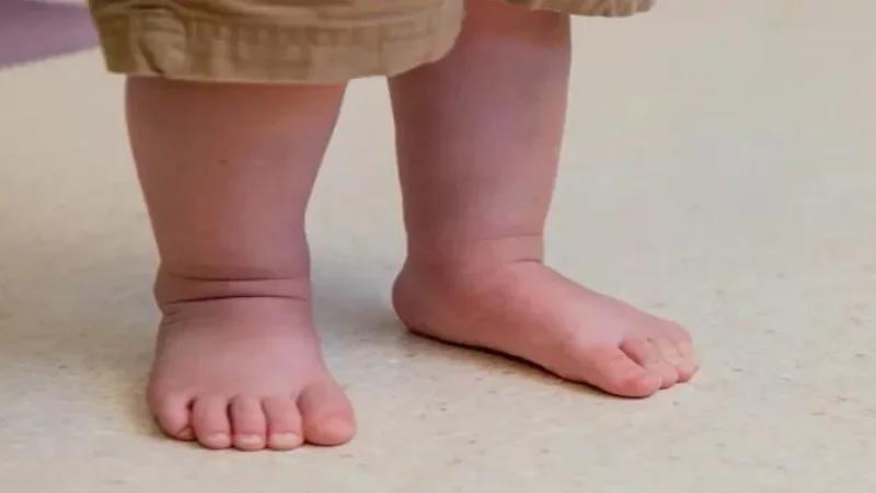 حي الزهور: رضيع ينجو من الموت بعد ابتلاعه قطع من الزطلة !