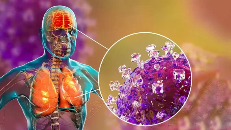 منظمة الصحة تُقلّل من احتمال انتشار فيروس 'نيباه' خارج الهند