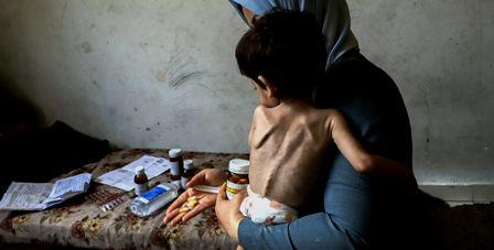 Les enfants continuent de mourir de faim et de déshydratation à Gaza