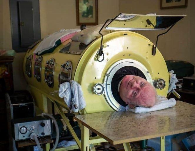 Paul Alexander, the ‘man in the iron lung’, dies aged 78